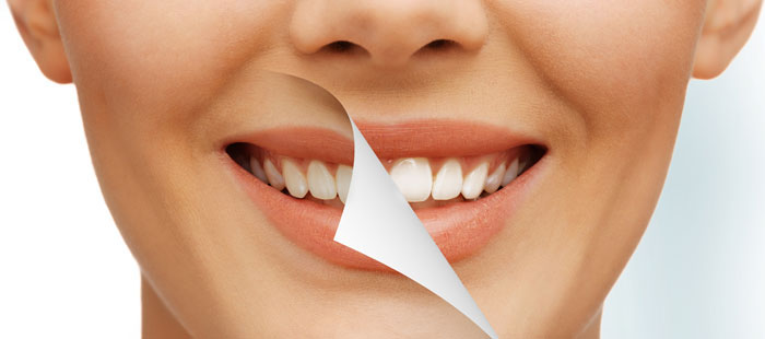 Whitening
