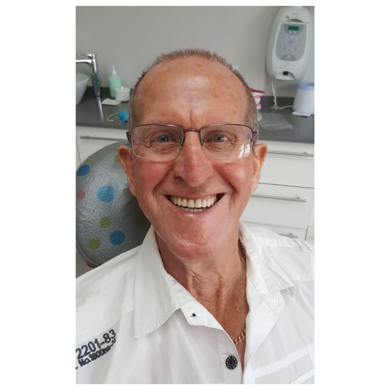 BA 2 Dentures 1
